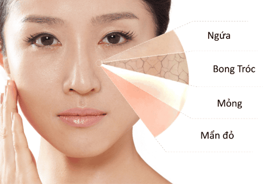 Da nhạy cảm là gì và vì sao dễ kích ứng khi dùng sữa tắm?
