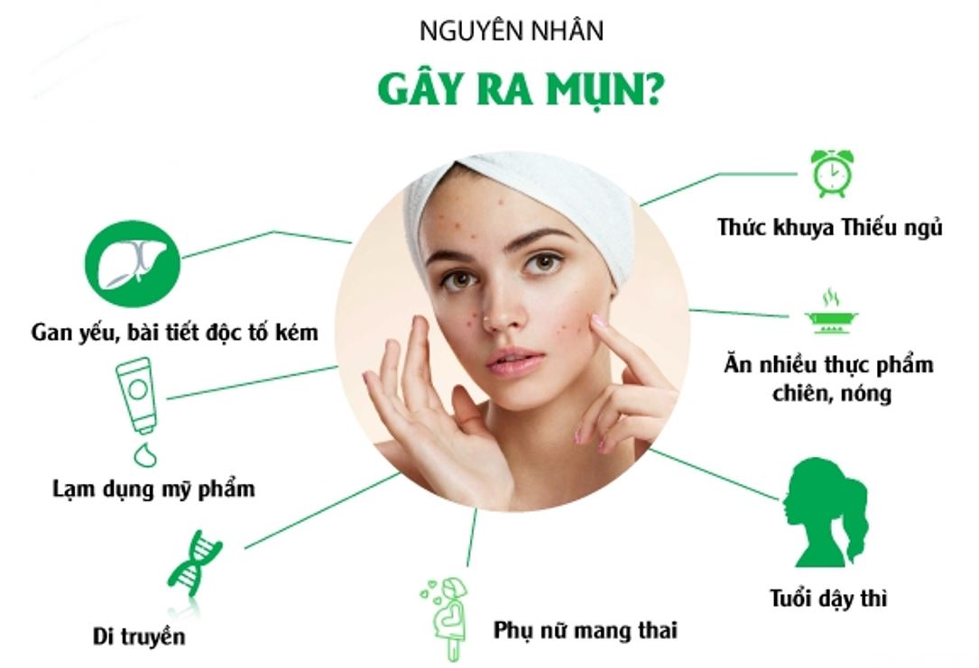 Nguyên Nhân Gây Mụn Và Cách Chăm Sóc Da Mụn Hiệu Quả